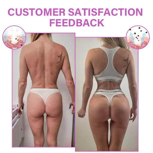 LOVILDS™ Curves | Breast + Buttock Enhancement