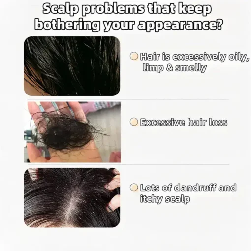 LOVILDS™ Ginseng Ginger Anti-Hair Loss Shampoo