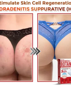 LOVILDS® MicroNeedle Botanic Skin Tag Removal Patch