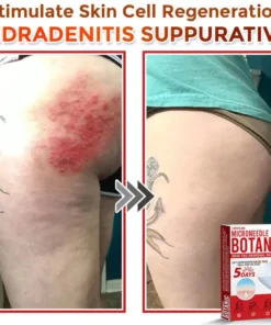 LOVILDS® MicroNeedle Botanic Skin Tag Removal Patch