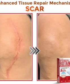LOVILDS® MicroNeedle Botanic Skin Tag Removal Patch