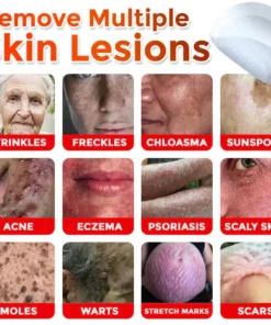 LOVILDS® MicroNeedle Botanic Skin Tag Removal Patch