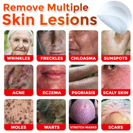 LOVILDS® MicroNeedle Botanic Skin Tag Removal Patch
