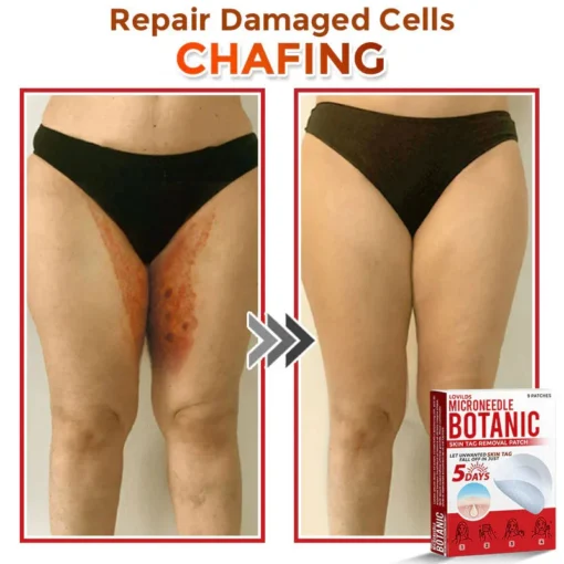 LOVILDS® MicroNeedle Botanic Skin Tag Removal Patch