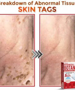 LOVILDS® MicroNeedle Botanic Skin Tag Removal Patch