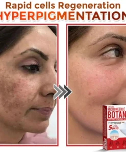 LOVILDS® MicroNeedle Botanic Skin Tag Removal Patch