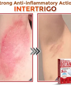 LOVILDS® MicroNeedle Botanic Skin Tag Removal Patch