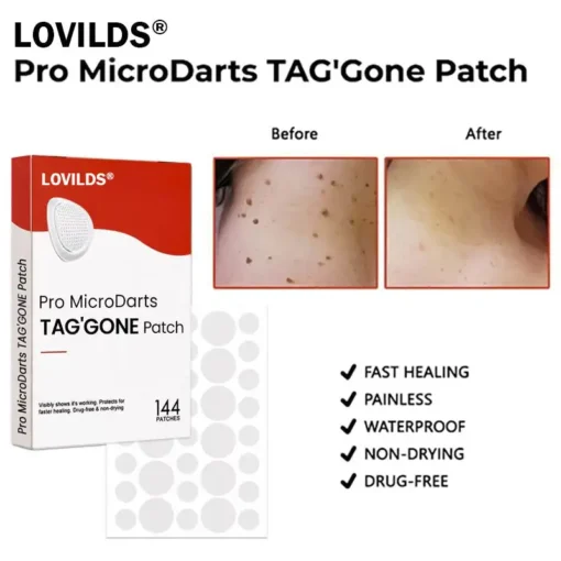 LOVILDS® Pro MicroDarts TAG'Gone Patch