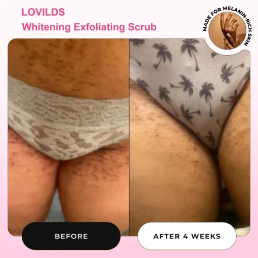 LOVILDS Whitening Exfoliating Scrub
