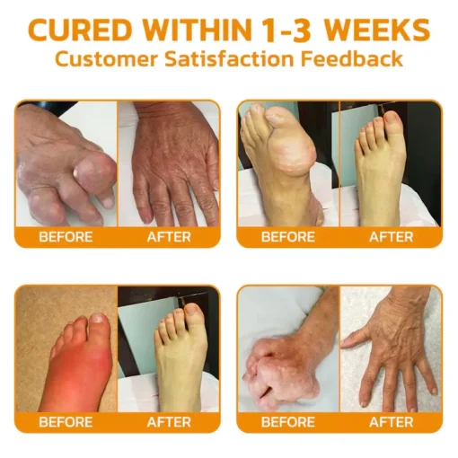 Lovilds® 𝐉𝐨𝐢𝐧𝐭 𝐑𝐞𝐥𝐢𝐞𝐟 𝐂𝐫𝐞𝐚𝐦