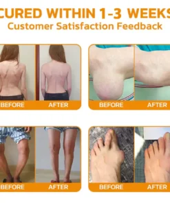 Lovilds® 𝐉𝐨𝐢𝐧𝐭 𝐑𝐞𝐥𝐢𝐞𝐟 𝐂𝐫𝐞𝐚𝐦