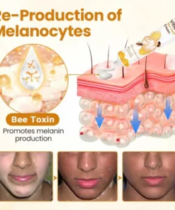 Lovilds® VitiCalm Bee Toxin Cream