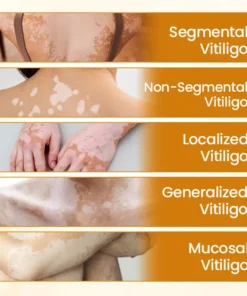 Lovilds® VitiCalm Bee Toxin Cream