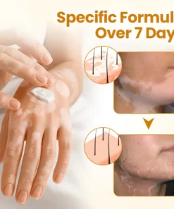 Lovilds® VitiCalm Bee Toxin Cream