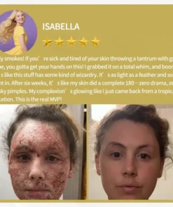 LOVILDS™ Apitoxin Cream — Trusted by Millions for Healthy, Glowing Skin