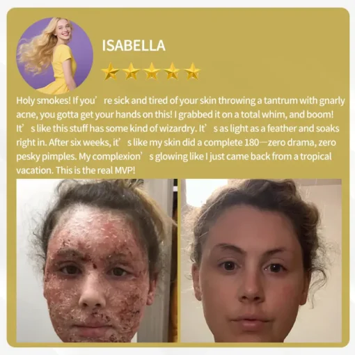 LOVILDS™ Apitoxin Cream — Trusted by Millions for Healthy, Glowing Skin