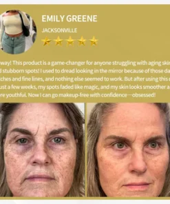 LOVILDS™ Apitoxin Cream — Trusted by Millions for Healthy, Glowing Skin