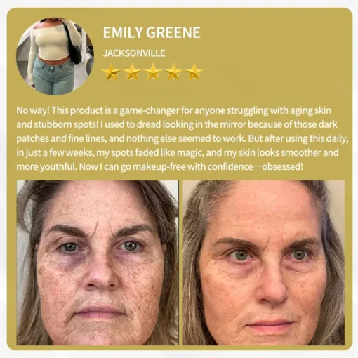 LOVILDS™ Apitoxin Cream — Trusted by Millions for Healthy, Glowing Skin