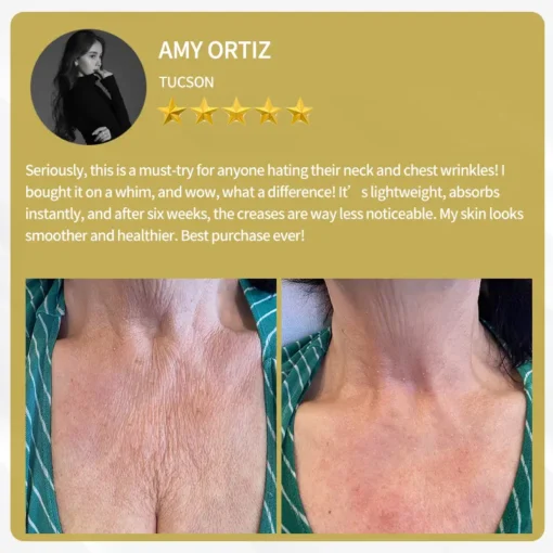 LOVILDS™ Apitoxin Cream — Trusted by Millions for Healthy, Glowing Skin