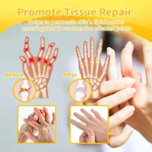 LOVILDS™ Bee poison Pain Relief and Bone Care Ointment