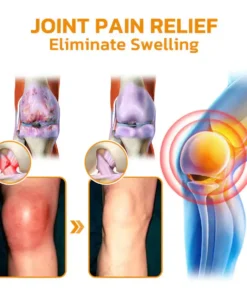 LOVILDS™ Bee poison Pain Relief and Bone Care Ointment