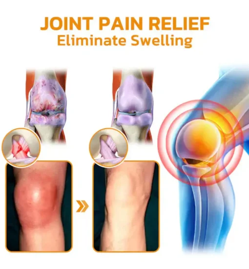 LOVILDS™ Bee poison Pain Relief and Bone Care Ointment