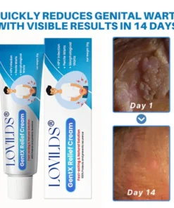 LOVILDS™ HPV Genital Warts Relief Cream