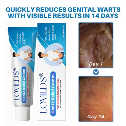 LOVILDS™ HPV Genital Warts Relief Cream