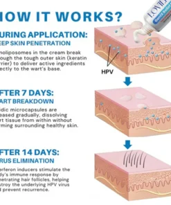 LOVILDS™ HPV Genital Warts Relief Cream