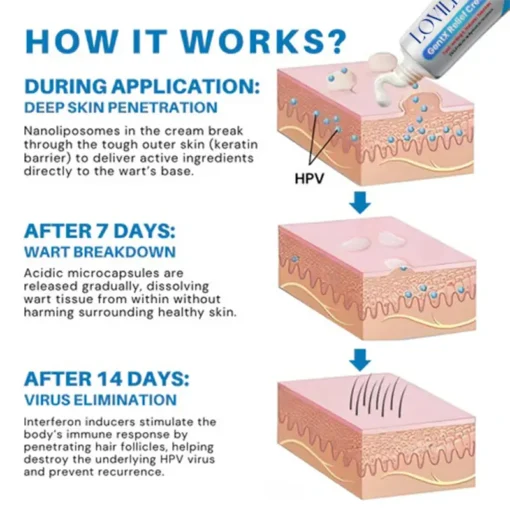 LOVILDS™ HPV Genital Warts Relief Cream