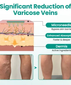 LOVILDS® LegRenew Varicose Veins Patch