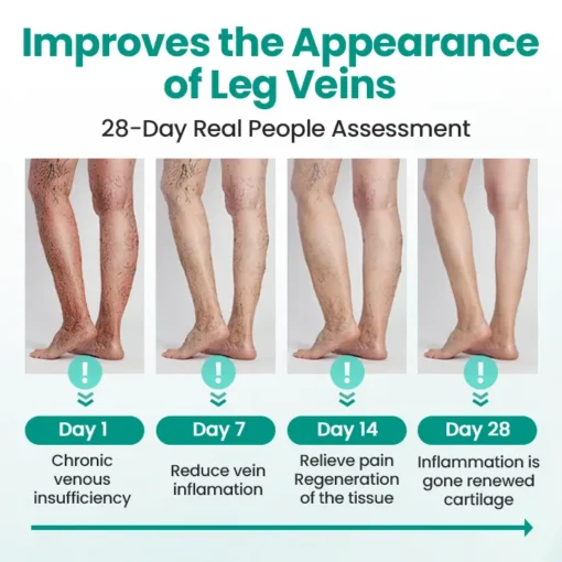 LOVILDS® LegRenew Varicose Veins Patch