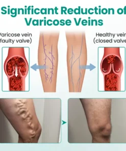 LOVILDS® LegRenew Varicose Veins Patch