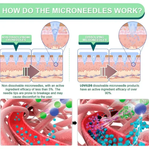 LOVILDS™ NIDDK-Tirzepatide Slimming & health NANO MICRONEEDLE PATCH
