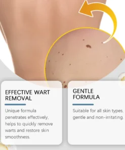 LOVILDS™ Non-Invasive Mole and Wart Removal Patch