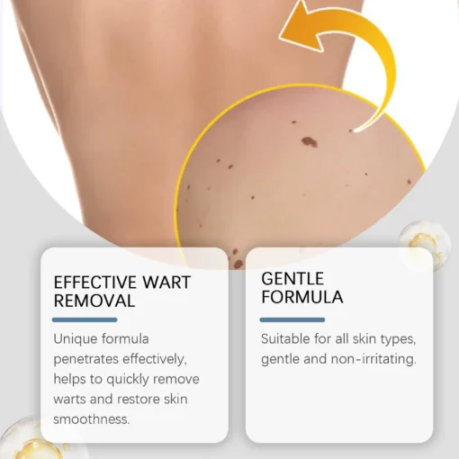 LOVILDS™ Non-Invasive Mole and Wart Removal Patch