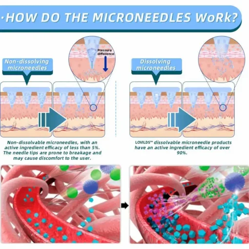【LOVILDS™ Official Store】 NIDDK-Tirzepatide Nano Microneedle Patch