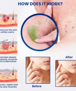 LOVILDS™ Ultra NatureErase Instant Mole & Spot Removal Gel