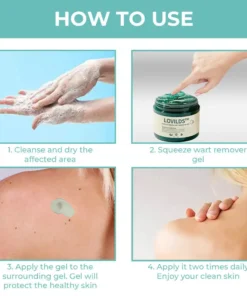 LOVILDS™ Ultra NatureErase Instant Mole & Spot Removal Gel