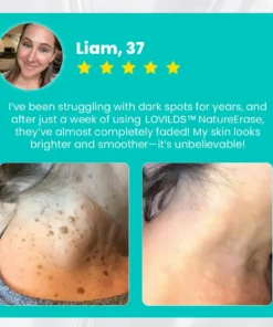 LOVILDS™ Ultra NatureErase Instant Mole & Spot Removal Gel
