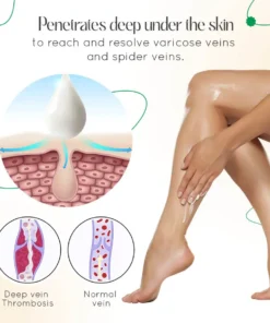 LOVILDS™ Vein Therapy Cream