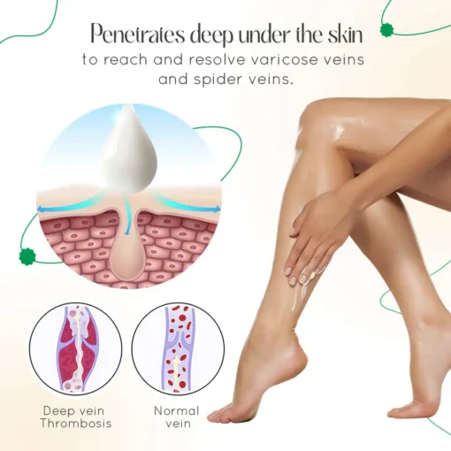 LOVILDS™ Vein Therapy Cream