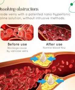 LOVILDS™ Vein Therapy Cream