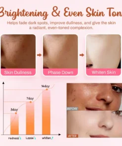 LOVILDS™ Whitening and Freckle - Removing Mask
