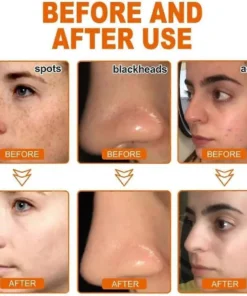 LOVILDS™ Whitening and Freckle - Removing Mask