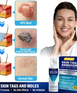 Lovilds® TagRecede Cryo Treatment Spray