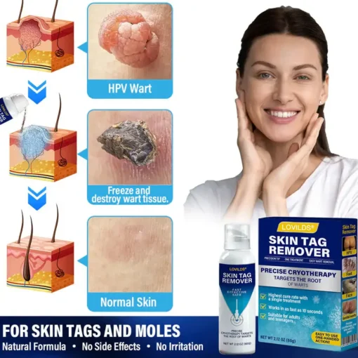 Lovilds® TagRecede Cryo Treatment Spray