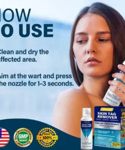 Lovilds® TagRecede Cryo Treatment Spray