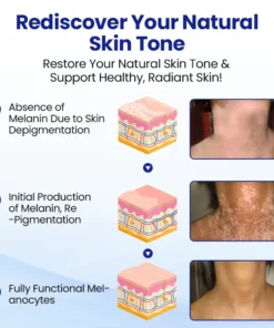 Lovilds® Vitiligo Treatment Spray
