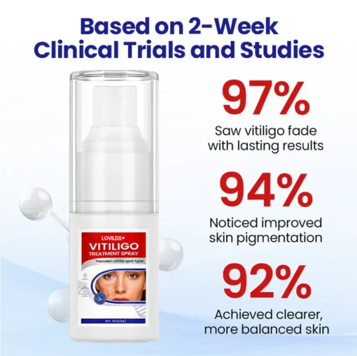 Lovilds® Vitiligo Treatment Spray